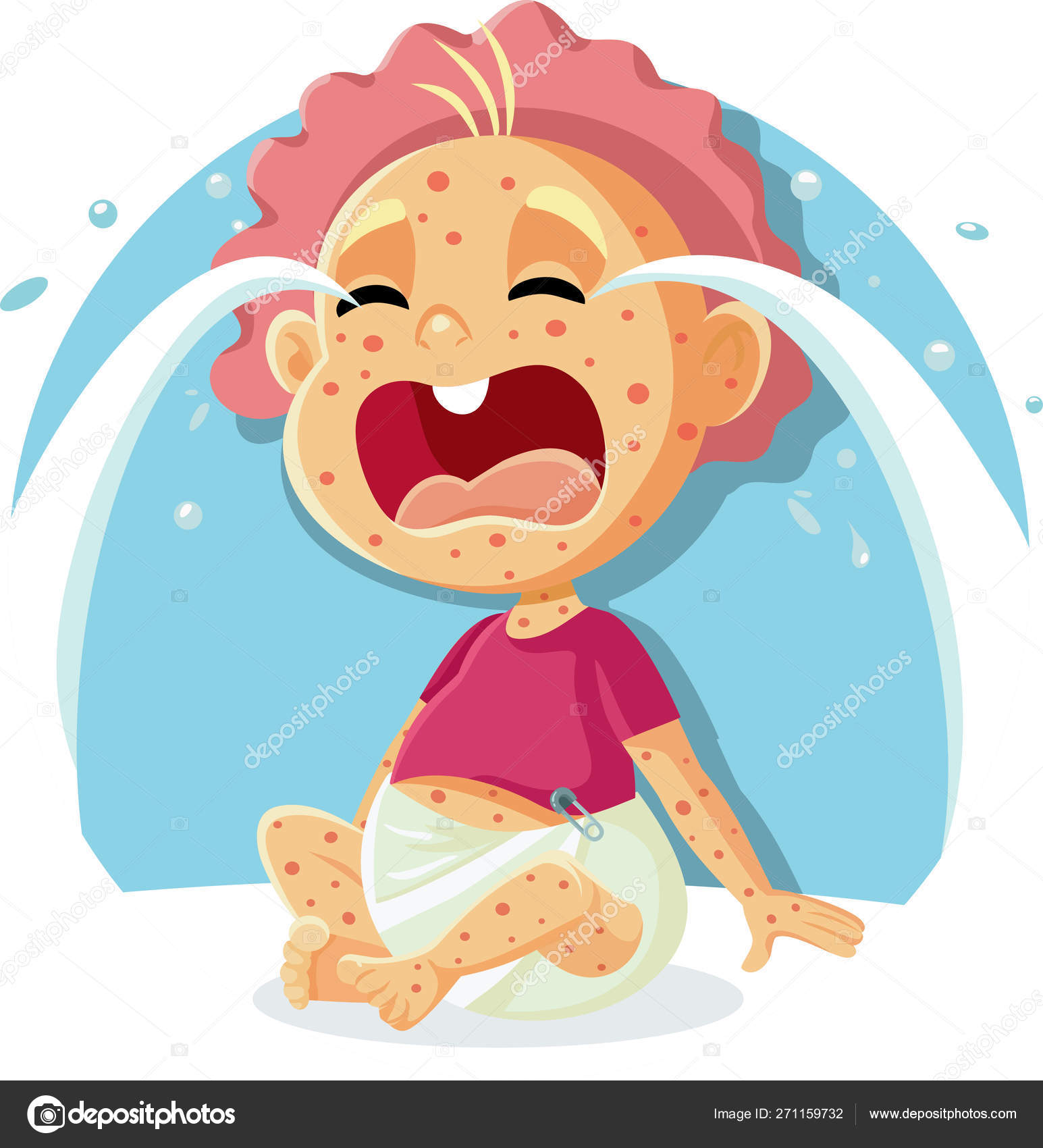 Chickenpox Vector Art Stock Images | Depositphotos Chickenpox Vector Art Stock Images | Depositphotos