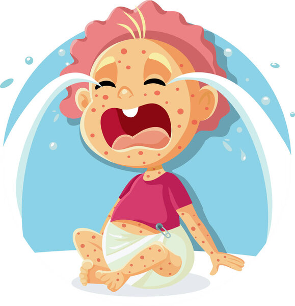  Sick Crying Baby with Measles Illustration