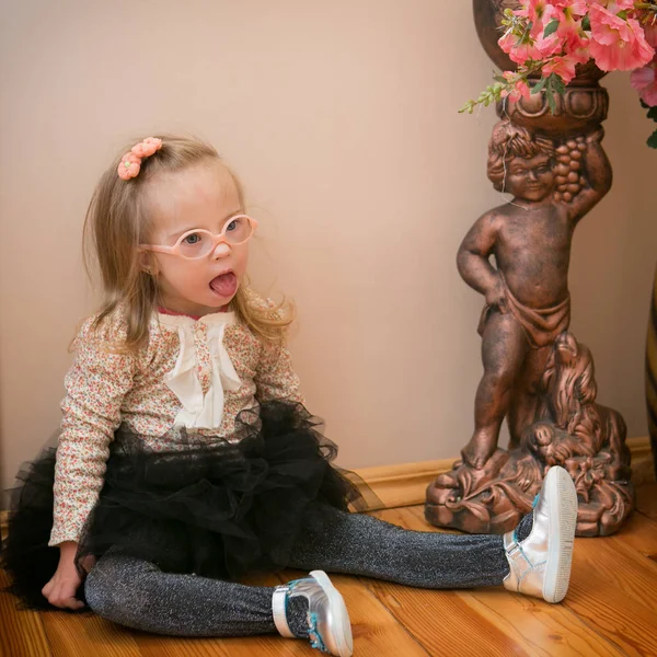 Portrét Dívky Downovým Syndromem — Stock fotografie