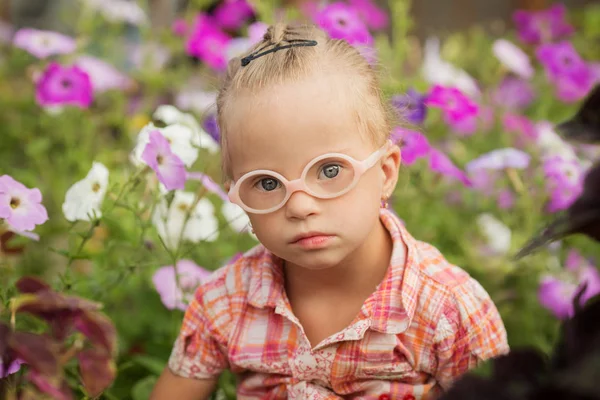 Krásný Portrét Dívky Downovým Syndromem — Stock fotografie