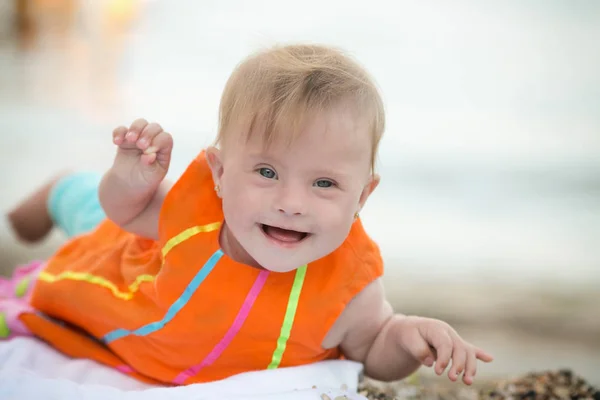 Lustiges Kleines Mädchen Mit Syndrom — Stockfoto