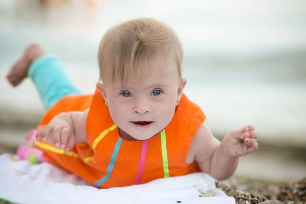 Lustiges Kleines Mädchen Mit Syndrom — Stockfoto