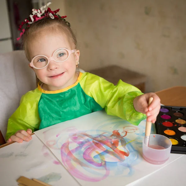 Bella Ragazza Con Sindrome — Foto Stock