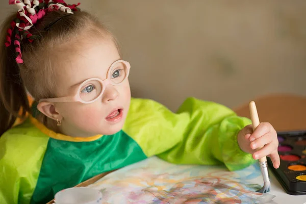 Schönes Mädchen Mit Syndrom — Stockfoto