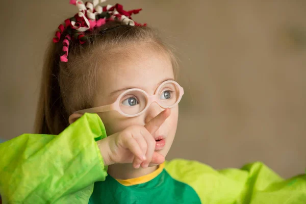 Bella Ragazza Con Sindrome — Foto Stock