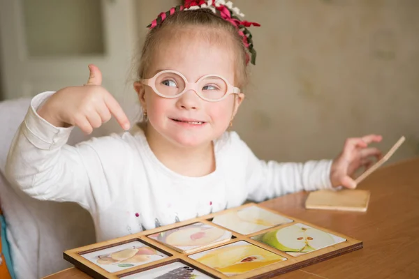 Krásná Dívka Downovým Syndromem — Stock fotografie