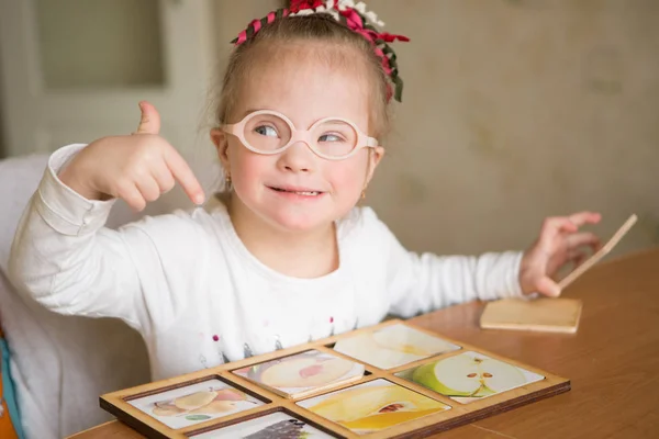 Schönes Mädchen Mit Syndrom — Stockfoto