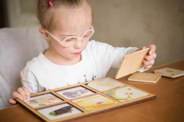 Krásná Dívka Downovým Syndromem — Stock fotografie