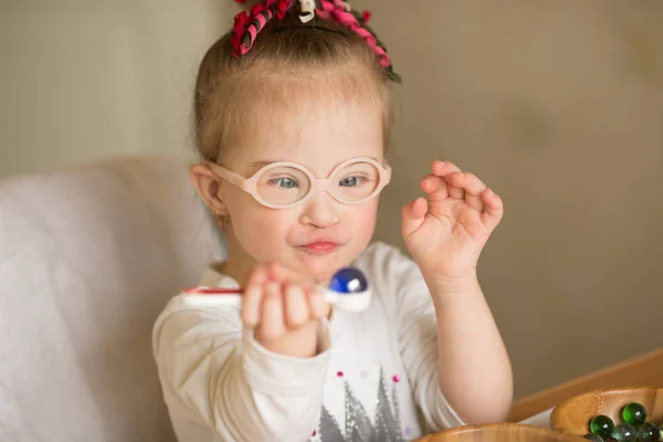 Krásná Dívka Downovým Syndromem — Stock fotografie