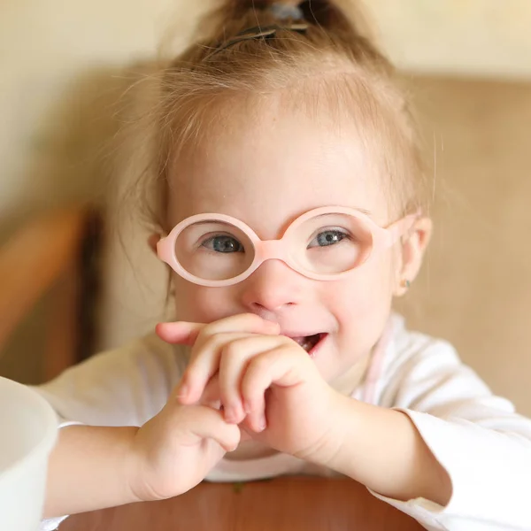 Retrato Una Niña Con Síndrome — Foto de Stock