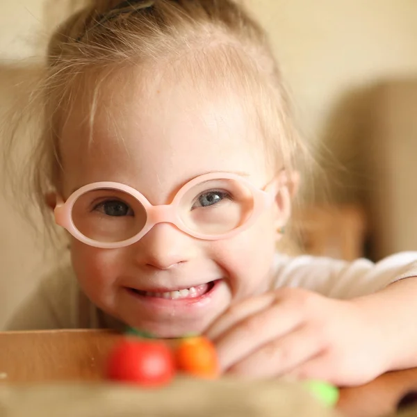 Meisje Met Syndroom Betrokken Bij Het Sorteren Van Groenten — Stockfoto