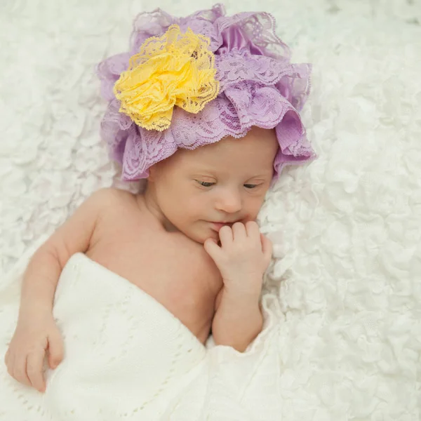 Retrato Una Hermosa Niña Recién Nacida Con Síndrome —  Fotos de Stock