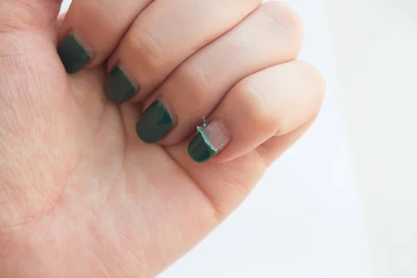 Kvinde Med Gammel Gel Polish Manicure Beskadiget Skrælning Lurvet Gel - Stock-foto