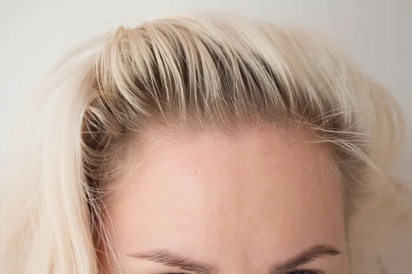 dark roots of hair, overgrown hair. hair roots, color, hair loss or dry scalp problem