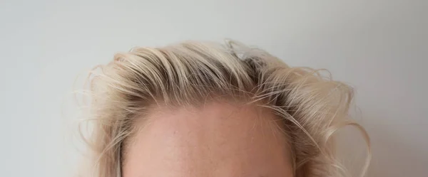 Dunkle Haarwurzeln Überwachsen Haarwurzeln Farbe Graue Haare Haarausfall Oder Trockene — Stockfoto