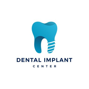 diş implantı logosu diş diş vektör simgesi