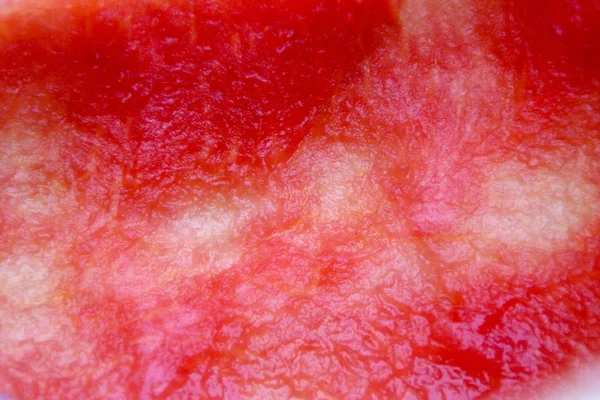 붉은 수박의 절반을 먹었다 — 스톡 사진