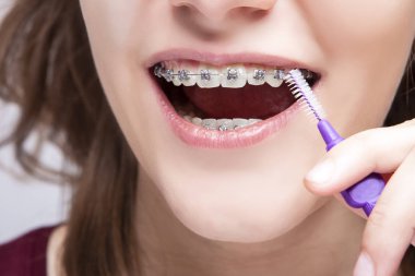 Diş Hijyeni Kavramları. Kadın Genç Ağız Extreme Closeup