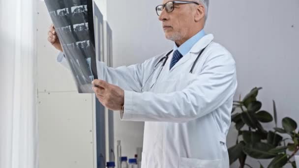 Ώριμος Γιατρός Που Εξετάζει Την Ακτινογραφία Και Την Αφαίρεση Γυαλιών — Αρχείο Βίντεο