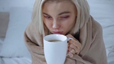 Hasta, genç bir kadın elinde çay fincanıyla kameraya bakıyor.