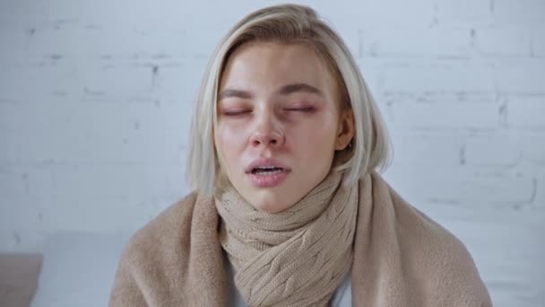 Mujer Joven Enferma Estornudando Tejido Casa — Vídeos de Stock