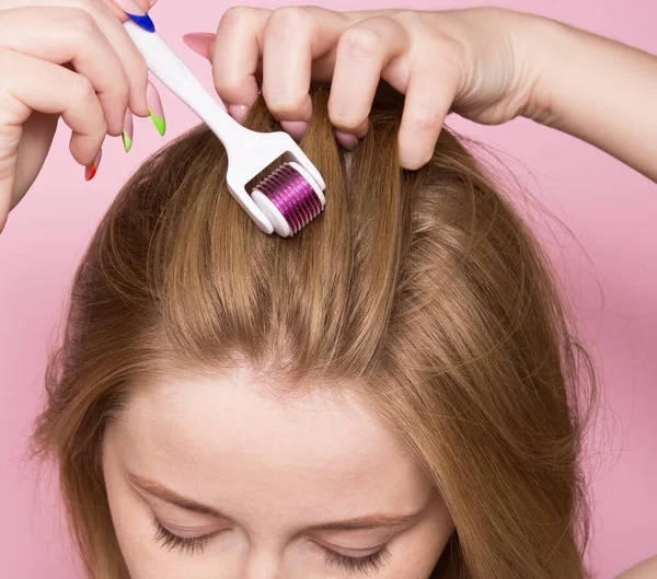 Mesotherapie Voor Haar Met Behulp Van Een Mesoroller Zorg Voor — Stockfoto