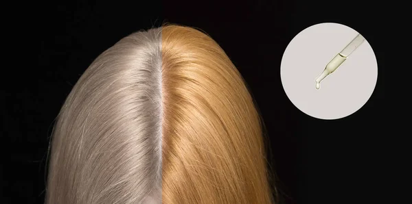 Pipeta Con Aceite Cosmético Círculo Texturas Cabello Incoloro Coloreado Preservación — Foto de Stock