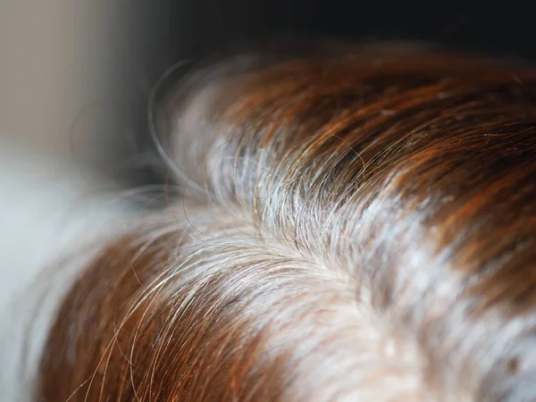 Cabelo Sentado Cabeça Uma Mulher — Fotografia de Stock