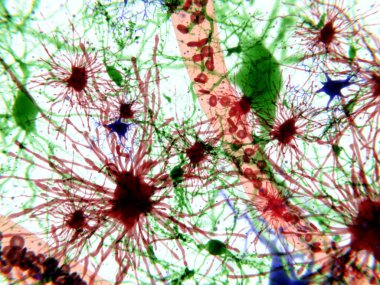 Beyin hücreleri: astrocytes (kırmızı), piramidal nöronların (kırmızı), microglia hücreleri (mavi)