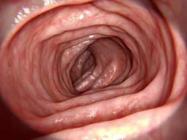 Endoskopi benzeri görüntü bir bağırsak herhangi bir hastalık olmadan. 