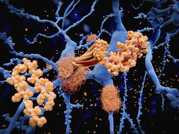 在被伽玛和Β分泌物裂解后 淀粉样Β肽 它有大约40个氨基酸残基 离开膜 改变形状和聚集成长纤维 这些纤维在神经细胞上形成致密斑块 这些斑块是在 — 图库照片
