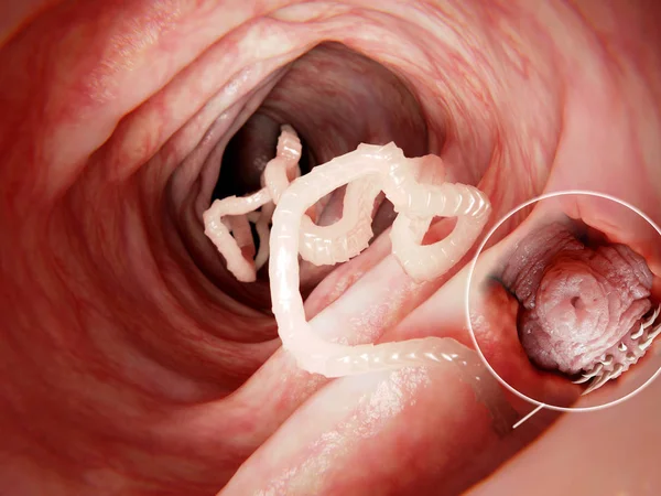 Tapeworms are a species of parasitic flatworms. They live in the digestive tracts of vertebrates