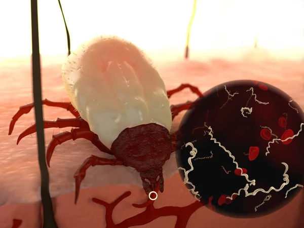Ticks External Parasites Feed Animal Human Blood Bite Can Cause — Stock Photo, Image