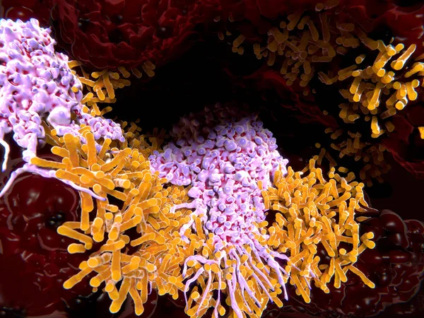 Makrofagi Che Inghiottono Batteri Della Tubercolosi Alveolo Polmonare — Foto Stock