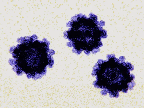 Norovirus Enfeksiyon Gastroenterit Sık Nedenidir Enfeksiyon Ishal Kusma Karın Ağrısı — Stok fotoğraf