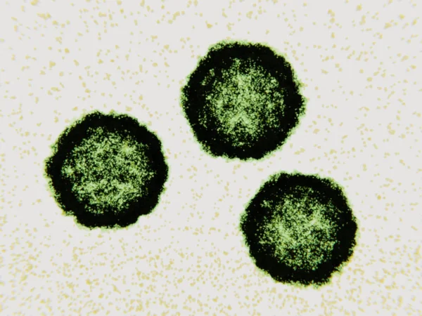 Coxsackievirus Zoals Het Poliovirus Behoort Tot Het Geslacht Enterovirus Zij — Stockfoto