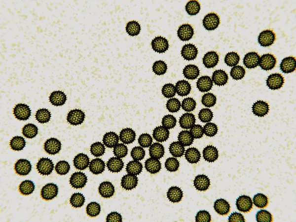 Hepatitis viruses cause a liver inflammation called hepatitis. There are acute and chronic forms. Hepatitis C can be transmitted through contact with blood. HCV is a RNA virus.