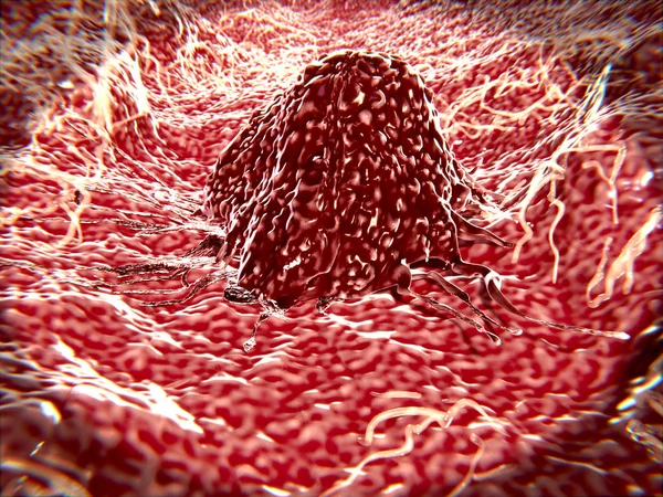 3d computer illustration of a migrating cancer cell. Cancer cells can migrate to other body tissues or organs building metastasis.