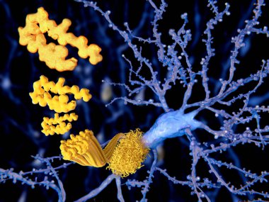 The beta amyloid peptid, amyloid plaques growing on a neuron. It consists of about 30 amino acids and aggregates to amyloid plaques, that may damage and kill neurons. Illustration clipart