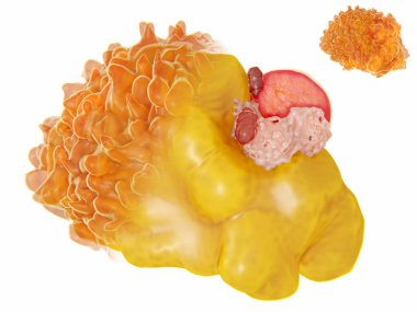Bir yağ hücre yapısını. 3D render. Yağ hücrelerinin büyük lipid damlacık (sarı), bir çekirdek (kırmızı) ve hücre organelleri çevre içinde yer alan içerir. İllüstrasyon