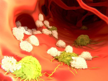 Cytotoxic T-lymphocytes attack migrating cancer cells. Illustration clipart
