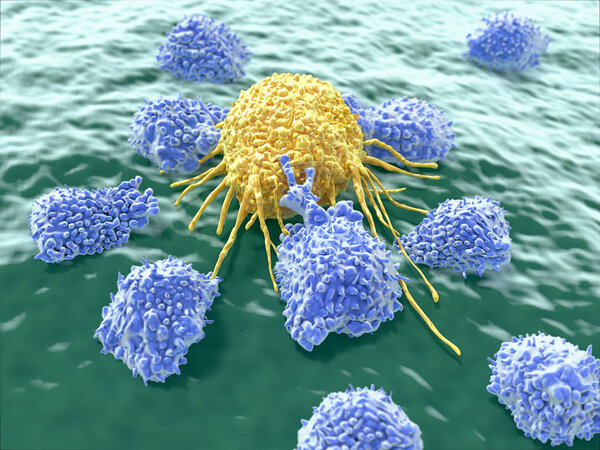 Cancer cell and lymphocytes. Illustration