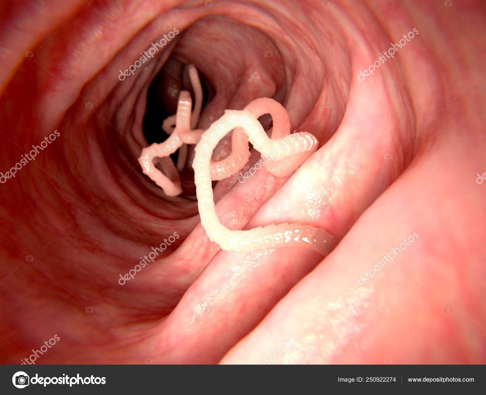 Parazitozele intestinale: giardioza si ascaridioza | Regina Maria - Paraziti digestivi