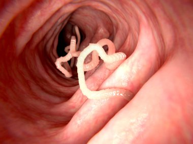 Tapeworm in human intestine. 3D rendering. Tapeworms are a species of parasitic flatworms. They live in the digestive tracts of vertebrates. Illustration clipart