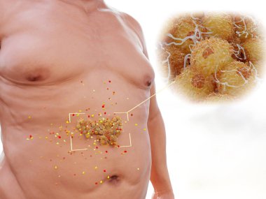 Visceral fat is highly hormonally active. 3d rendering. Illustration clipart