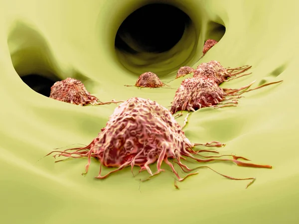 Migrar Células Cancerígenas Ilustração — Fotografia de Stock