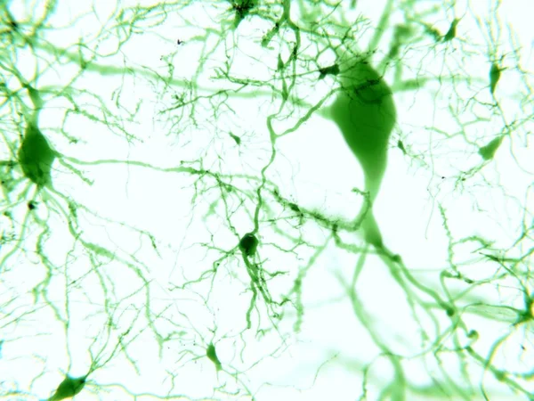 Human Pyramidal Neurons Illustration — Stock Photo, Image