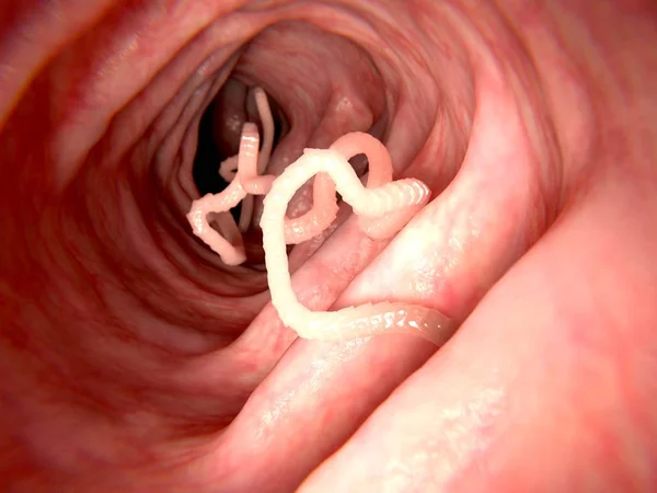 Tapeworm Human Intestine Rendering Tapeworms Species Parasitic Flatworms Live Digestive — Stock Photo, Image