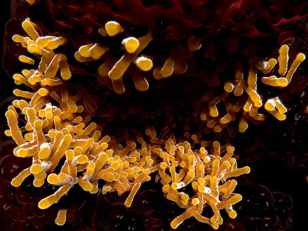 Туберкулёз Бациллы Легких Туберкулез Вызван Бактерией Mycobacterium Tuberculosis — стоковое фото