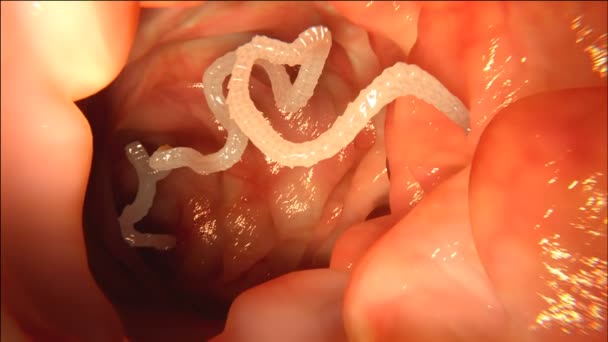 Tapeworm Insan Bağırsak Içinde — Stok video